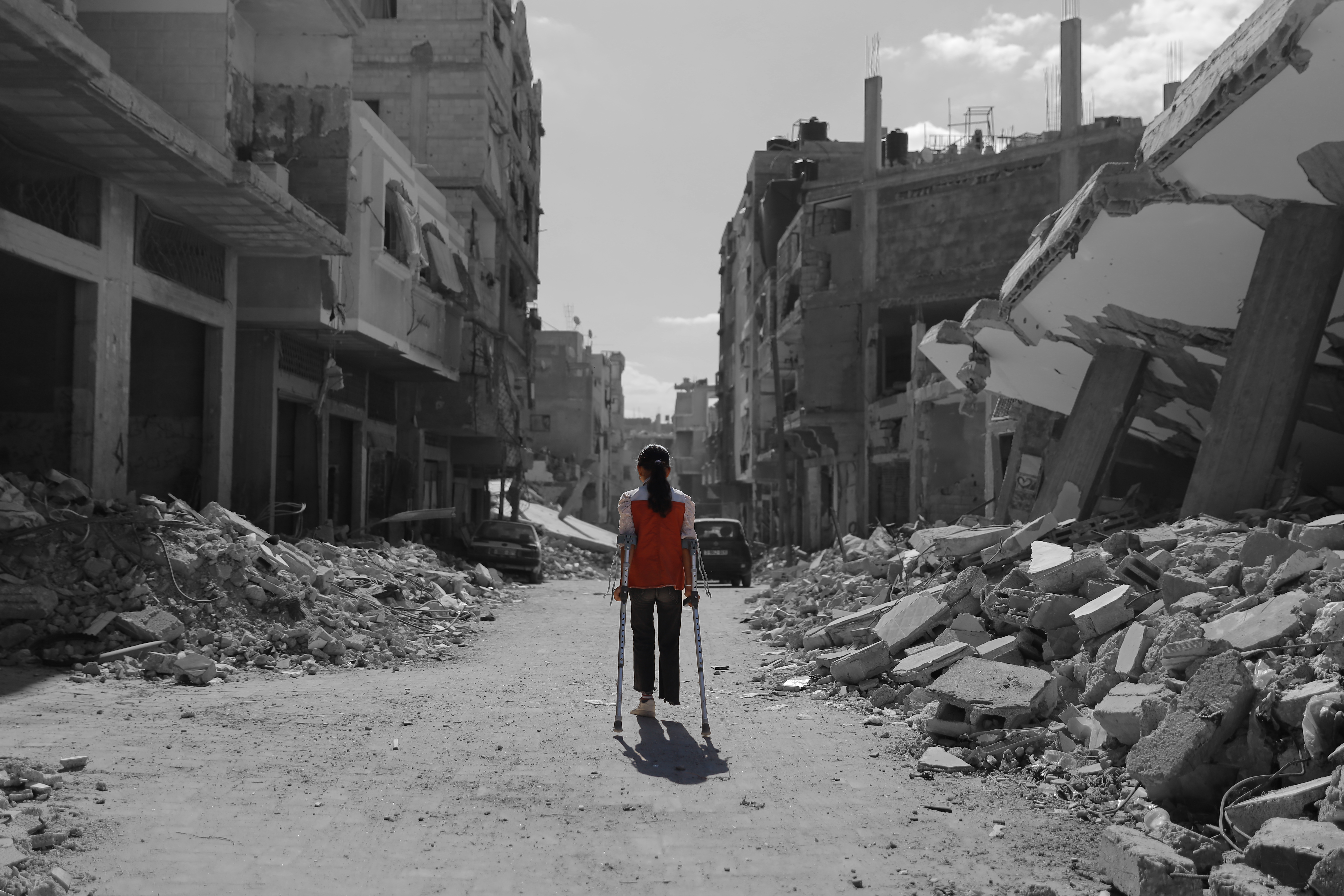 Help Children Like Leen Walk Again